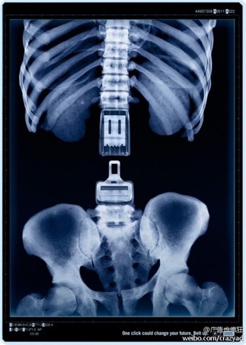 ��У���̵�֪ʶ(6) �����г���13������