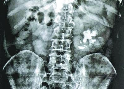 ���������һҳ